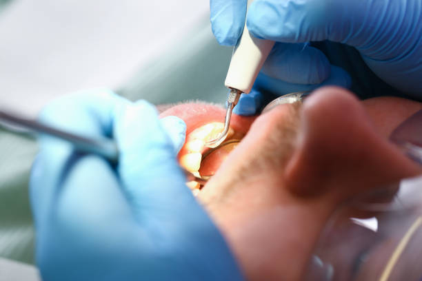 Best Orthodontic Emergency Dentist in Hillsboro, MO